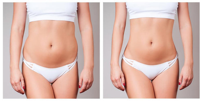 Everything You Need to Know About Liposuction