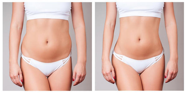 Everything You Need to Know About Liposuction - Foxy Beauty