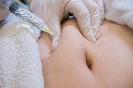 Lipo Lab Treatment Areas: Get Rid of Stubborn Fat with Targeted Solutions - Foxy Beauty