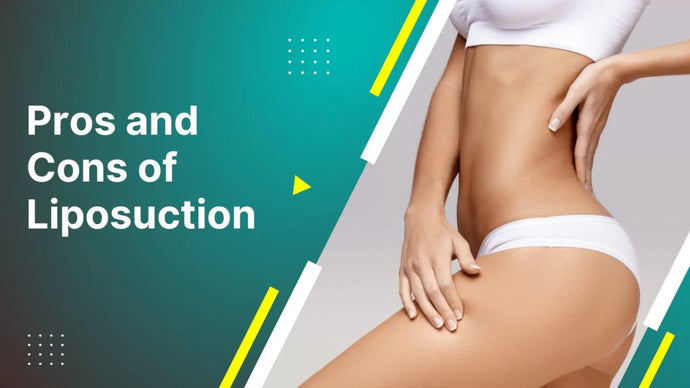 The Pros and Cons of Liposuction