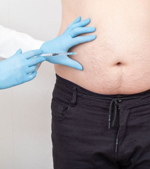 Top 5 Myths about Lipolysis Injections