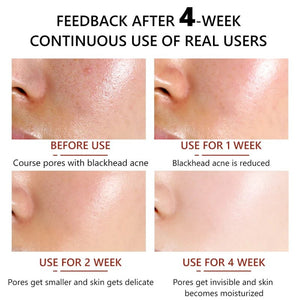 Advanced Pore-Reducing Skin Refiner