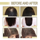 EELHOE hair growth oil