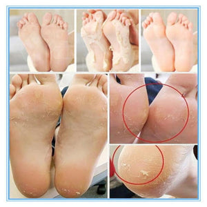 Foot Peeling Mask