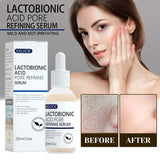 Lactobionic Acid Serum - Pore Minimizer Serum