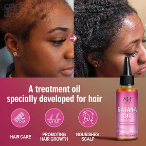 Batana Oil South Africa Hair Growth Treatment