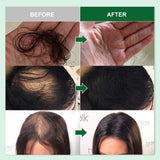 Rosemary Ginger Hair Growth Oil Treatment